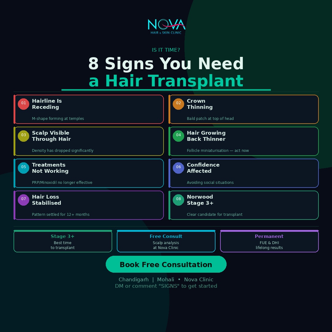8-Clear-Signs-You-Need-a-Hair-Transplant