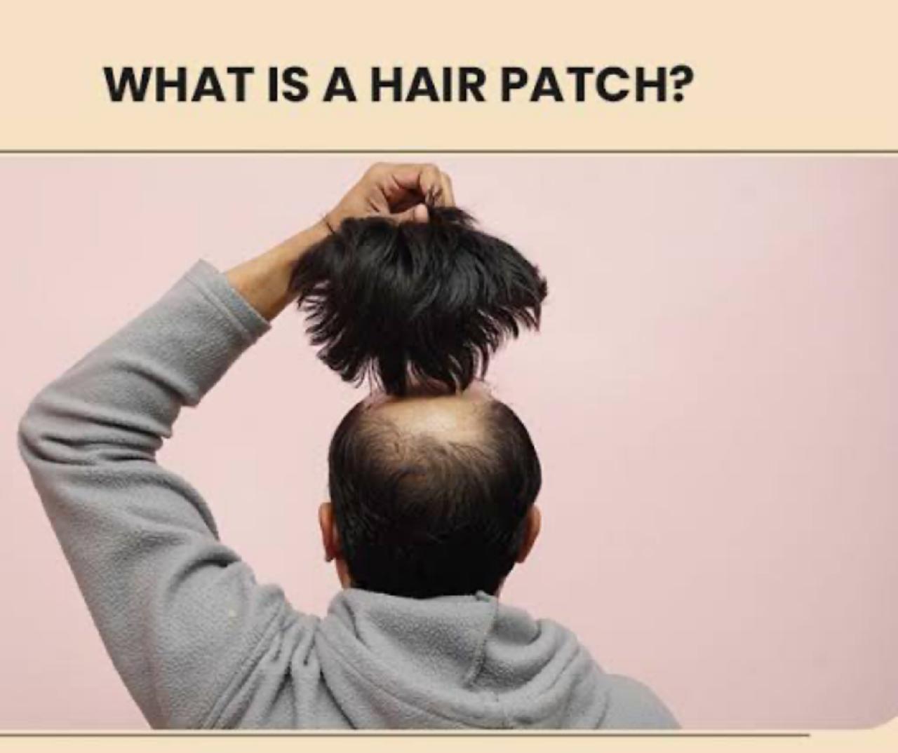 Hair-Transplant-vs-Hair-Wigs