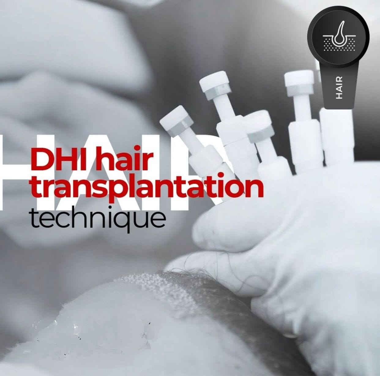 Dhi ( Direct Hair Implantation )