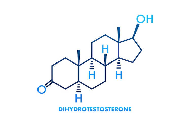 the-Hormone-Behind-Hair-Loss