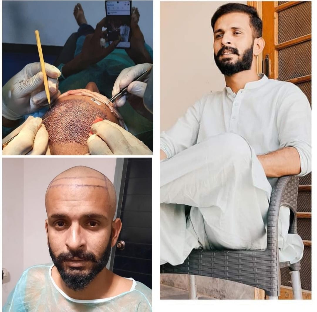 Hair-Restoration-Excellence