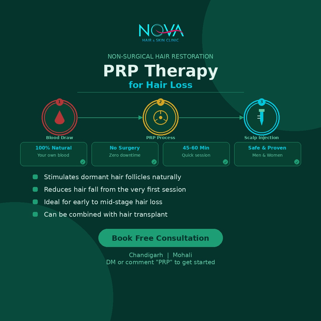 PRP-Therapy-for-Hair-Loss